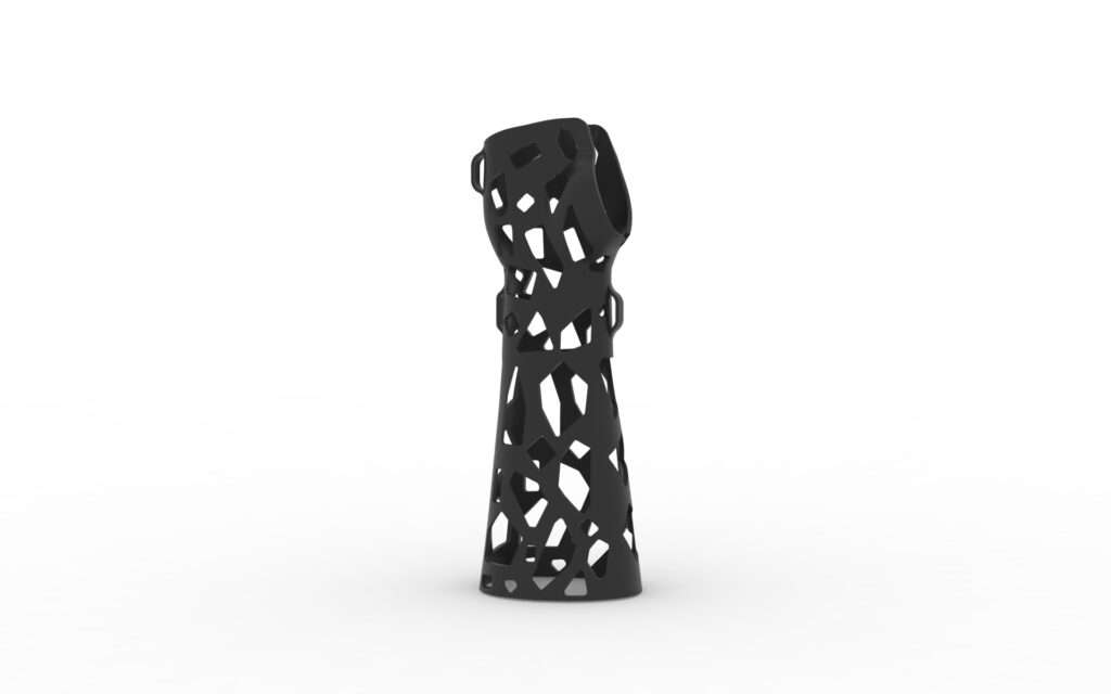 3D Printed Orthopedic Plaster