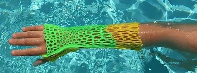 3D Orthopedic Plaster in Water Pool